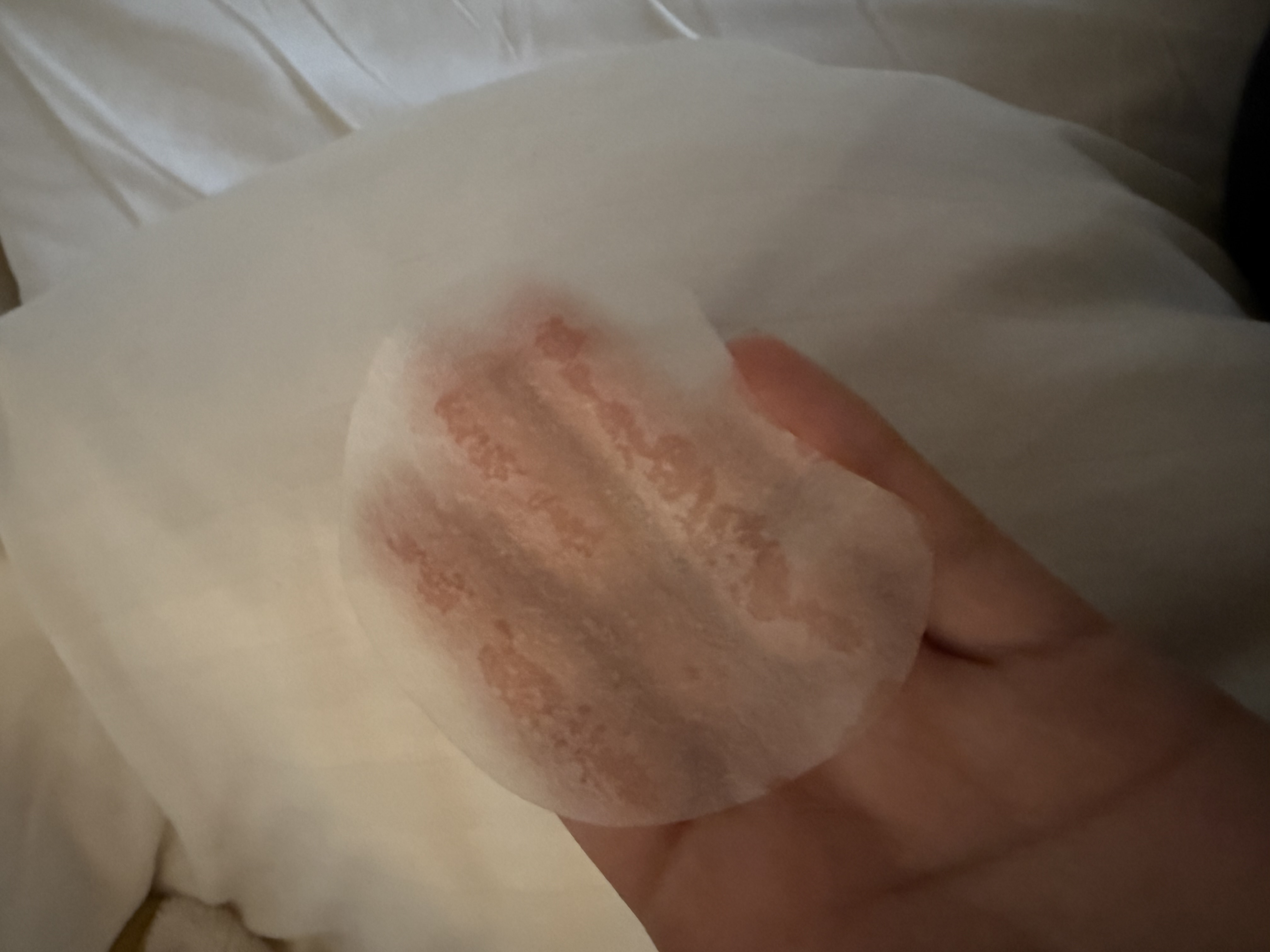 センテラ クイックカーミングパッド/SKIN1004/トナーパッドを使ったクチコミ（3枚目）