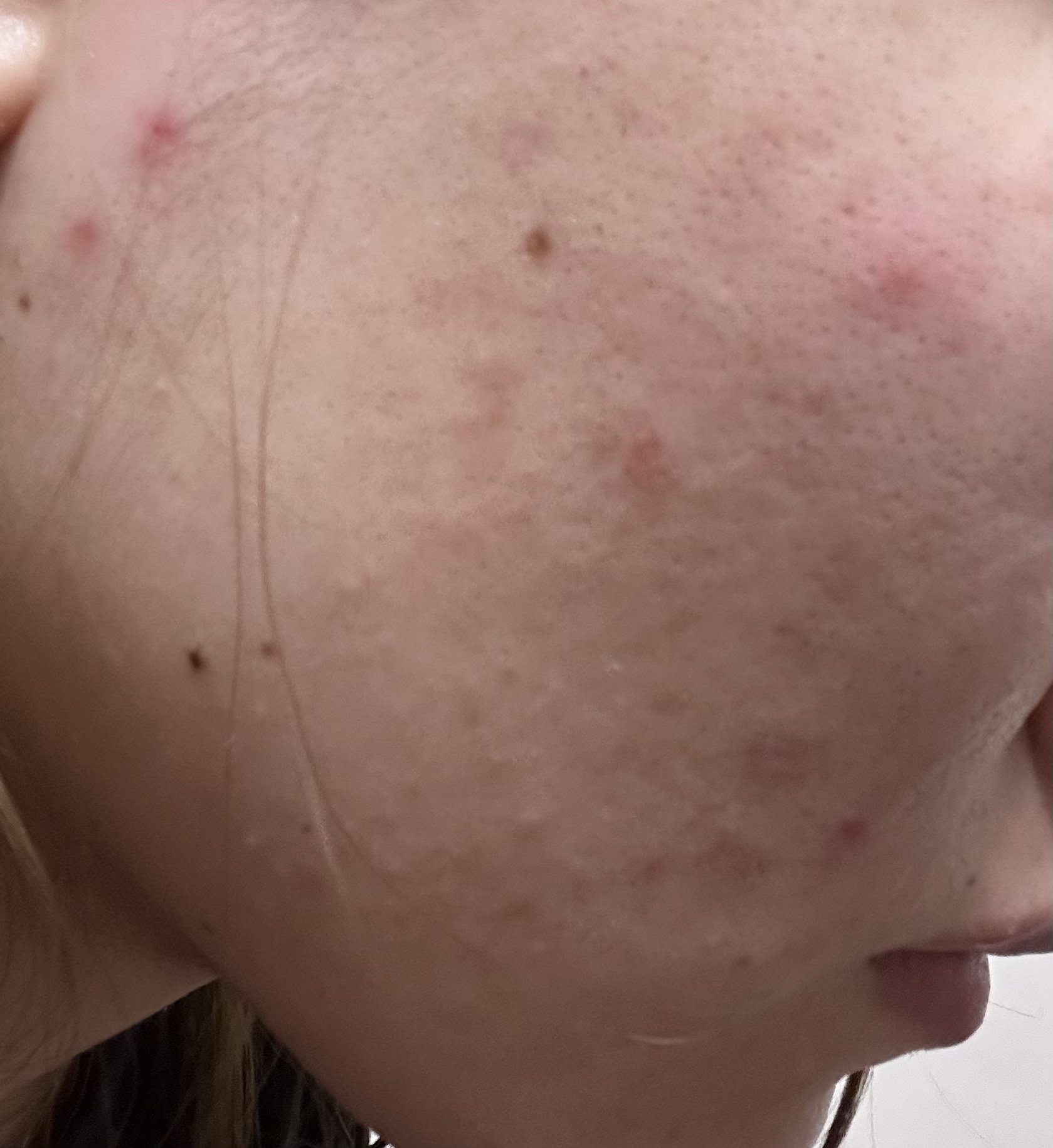 1番 ガルバニックパントテン酸スージングセラム/numbuzin/美容液を使ったクチコミ（2枚目）