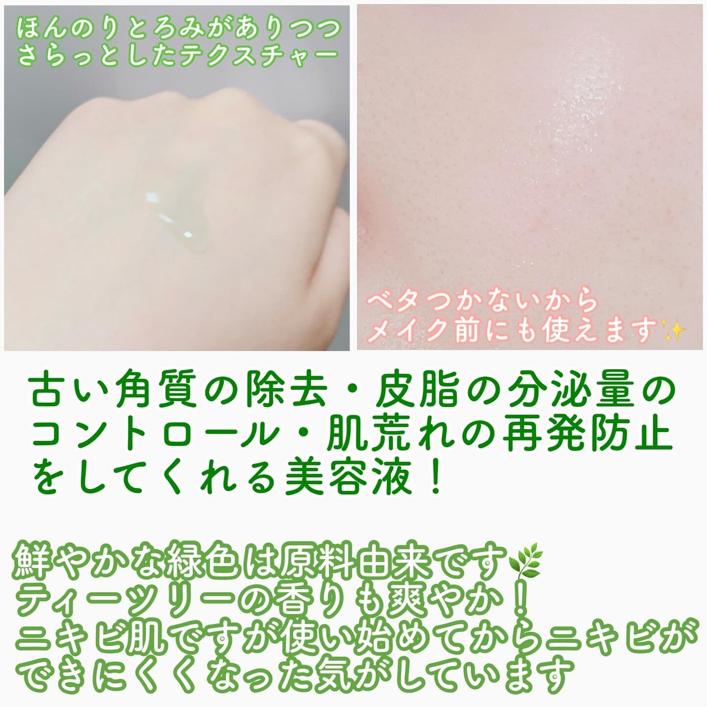 ベターツリカン肌荒れ美容液/Mildlab/美容液を使ったクチコミ(2枚目)