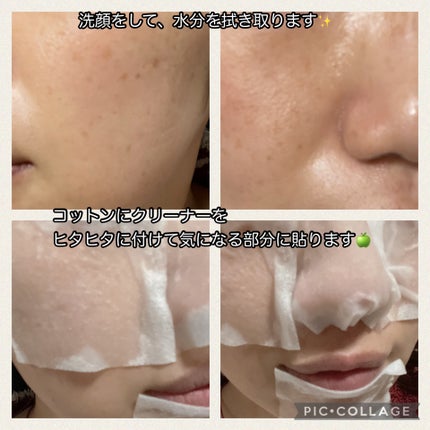 ナチュラルマイルドクリアノーズパック/ilso/シートマスク・パックを使ったクチコミ(2枚目)