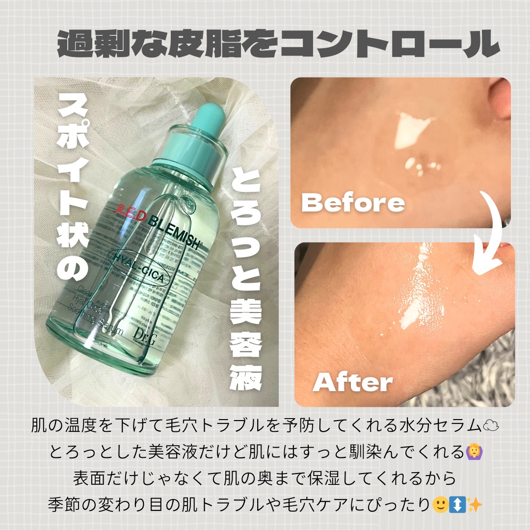 レッドブレミッシュ クリアスージングクリーム/Dr.G/フェイスクリームを使ったクチコミ（2枚目）