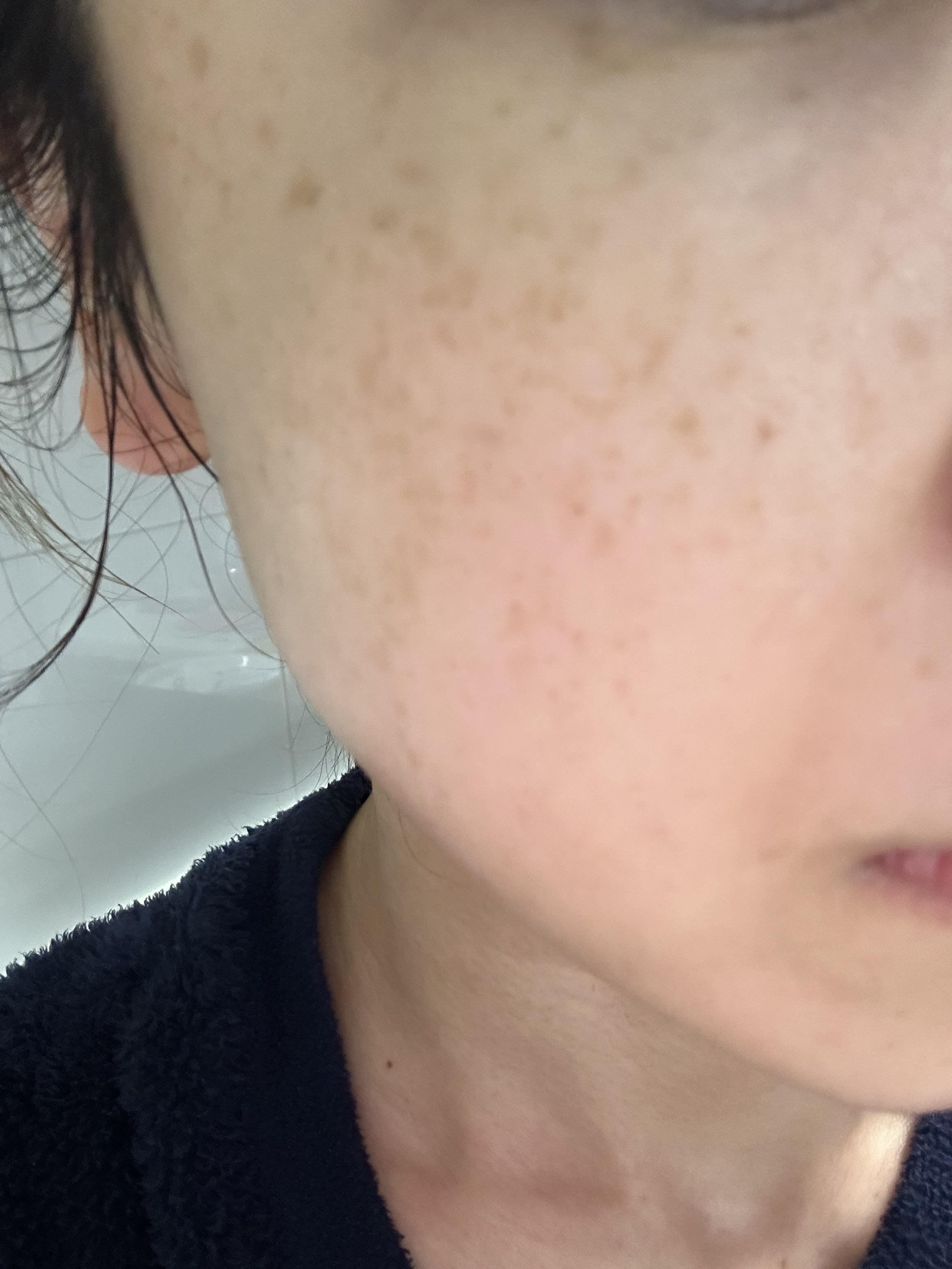 グルタチオンショットB3シミ跡セラム/It's skin/美容液を使ったクチコミ（3枚目）