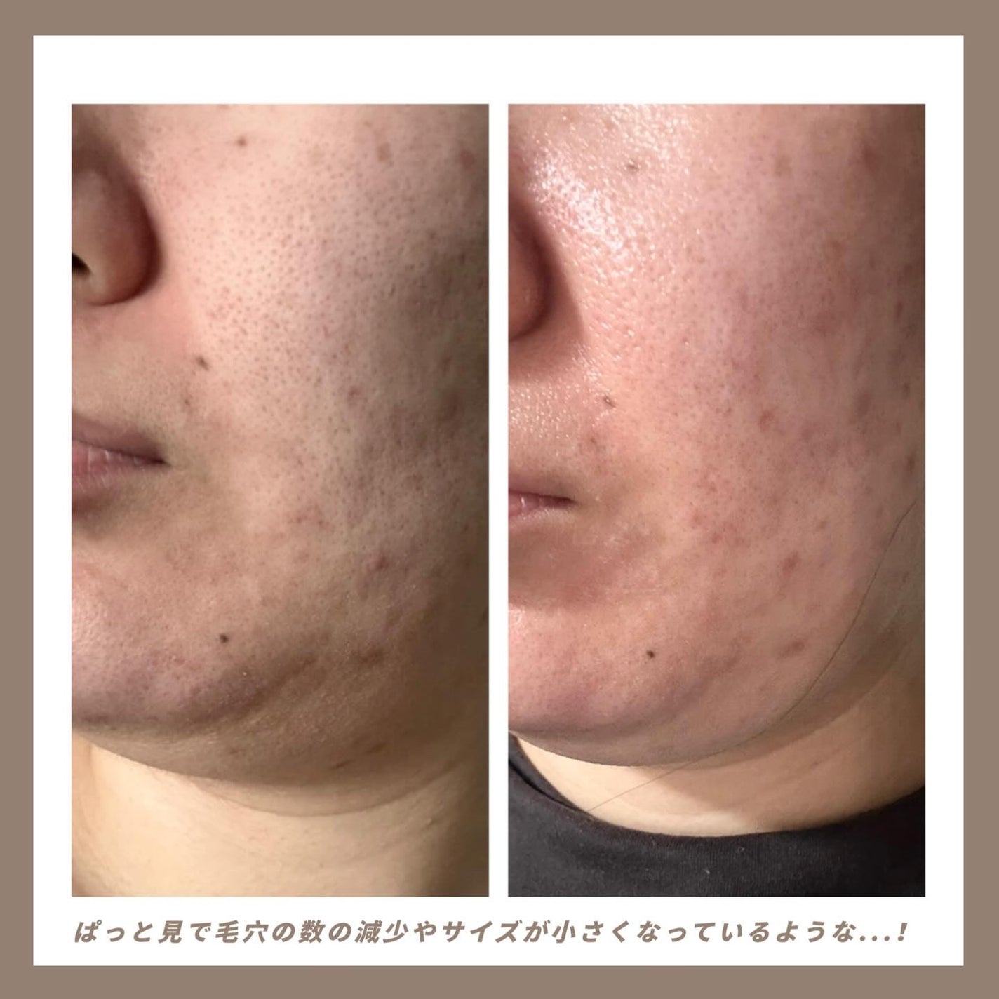 PDRNカフェインショット/IOPE/美容液を使ったクチコミ(3枚目)