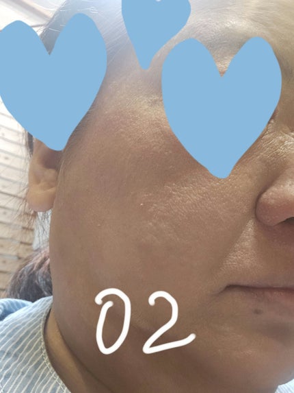 クリームチーク/無印良品/ジェル・クリームチークを使ったクチコミ(5枚目)