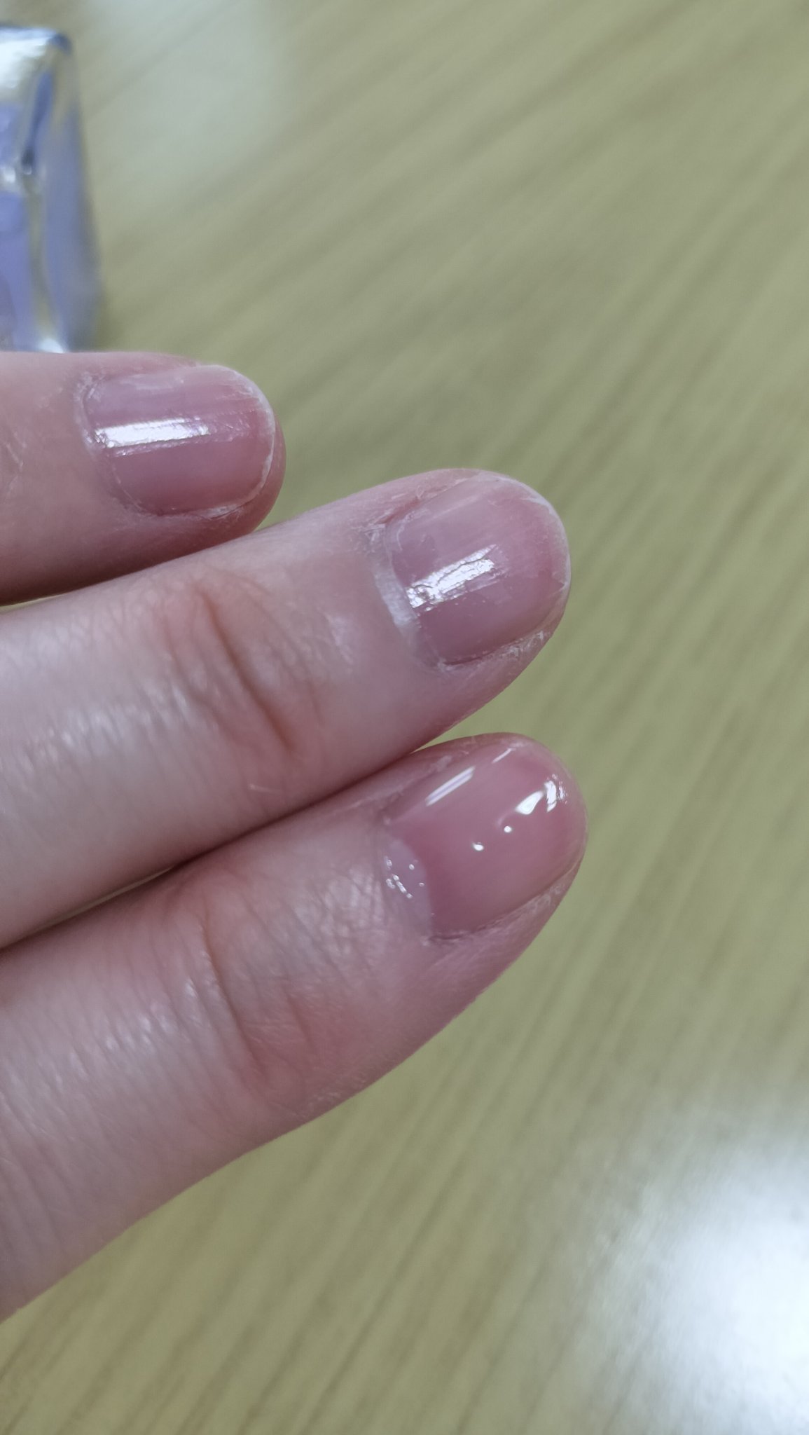 ラスティングエッセンス/ネイリスト/ネイルオイル・トリートメントを使ったクチコミ（3枚目）