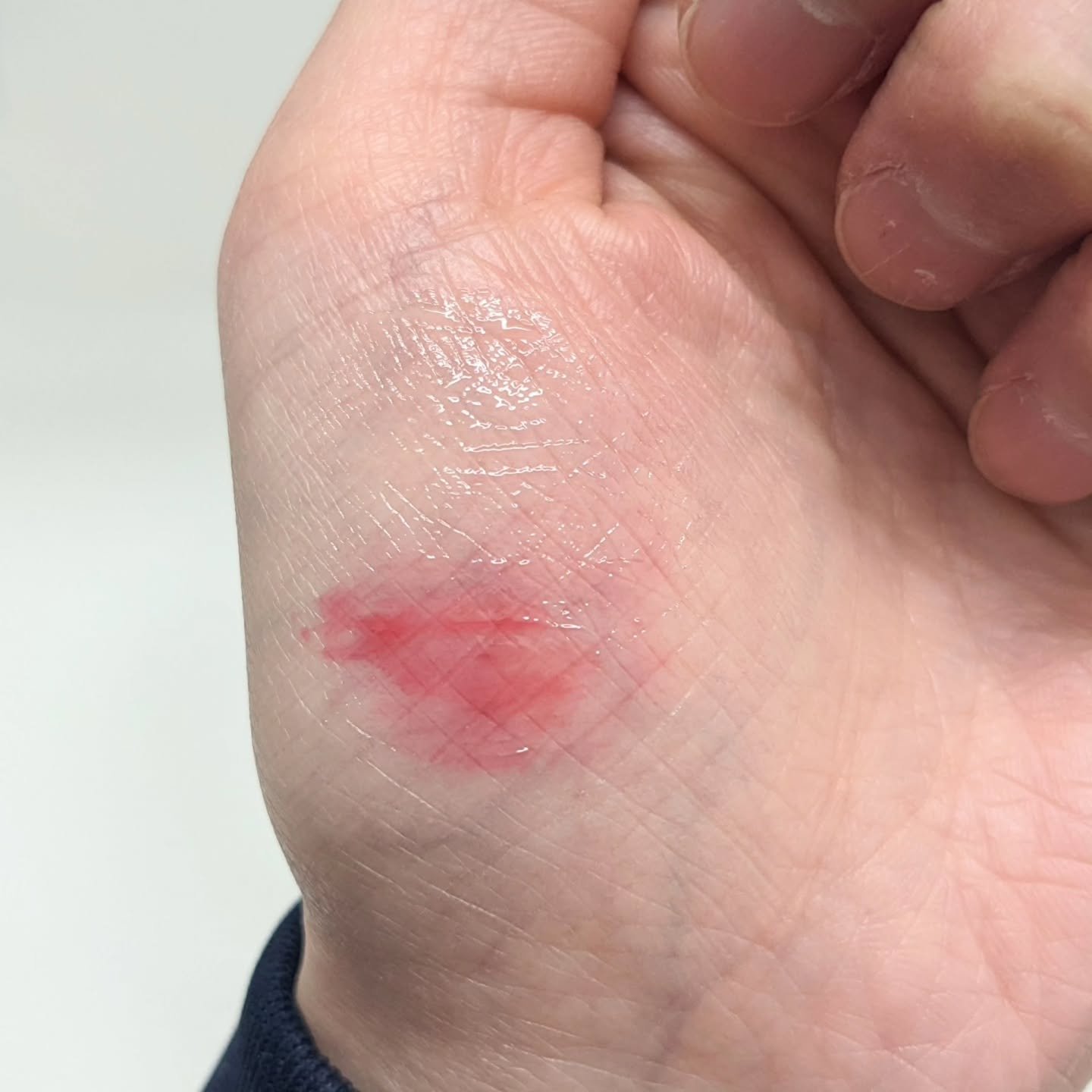 レチノール ボリューム リップセラム/primera/リップグロスを使ったクチコミ（2枚目）