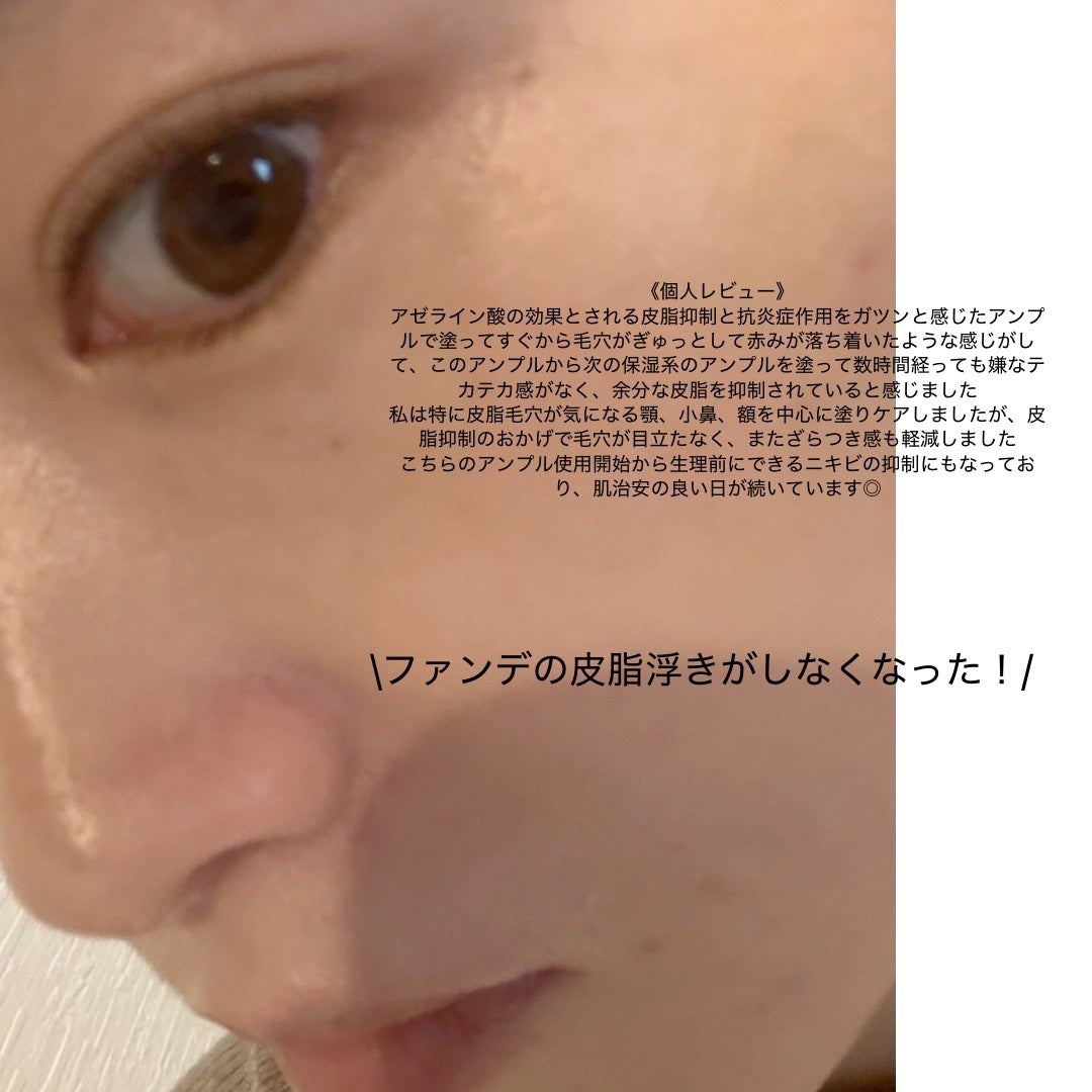 ダーマアンサーアゼライン酸ミントアンプル/CNP Laboratory/美容液を使ったクチコミ(3枚目)