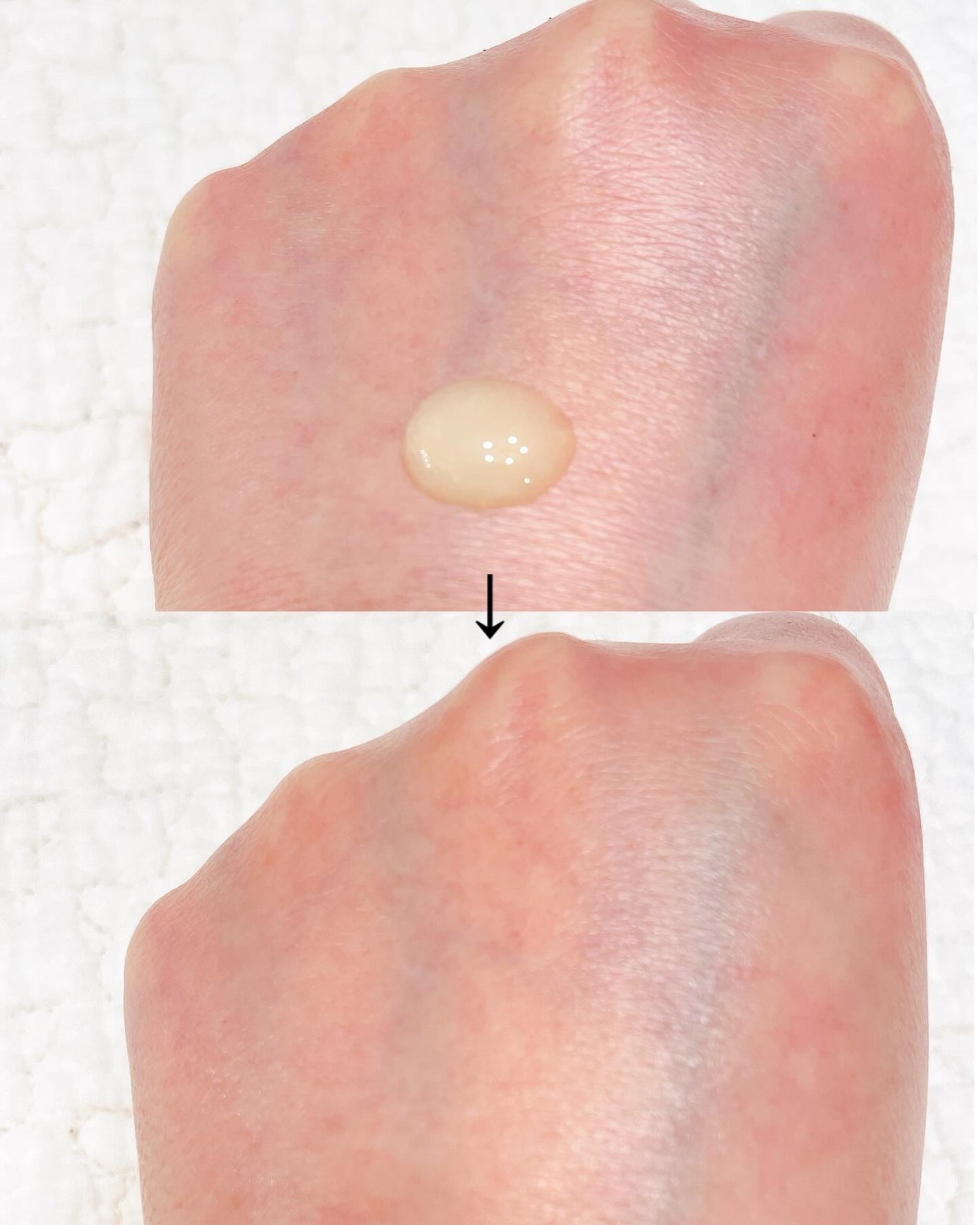 レチナールスキンブースターセラム15mL/MEDITHERAPY/ブースター・導入液を使ったクチコミ(2枚目)