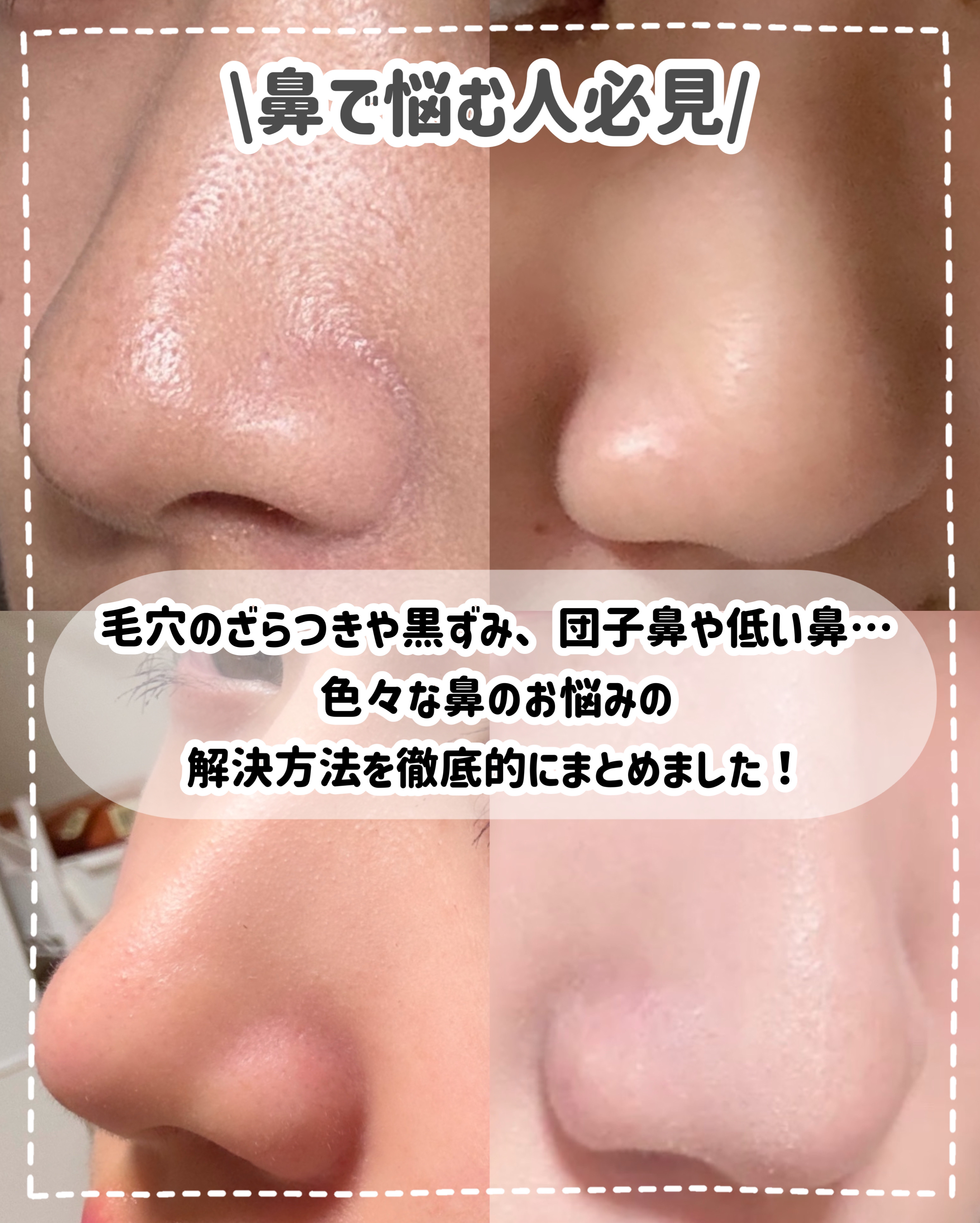 ハトムギ保湿ジェル(ナチュリエ スキンコンディショニングジェル)/ナチュリエ/美容液を使ったクチコミ（2枚目）