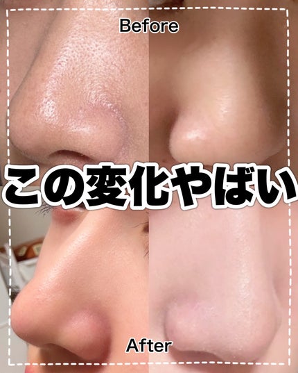 ハトムギ保湿ジェル(ナチュリエ スキンコンディショニングジェル)/ナチュリエ/美容液を使ったクチコミ(9枚目)