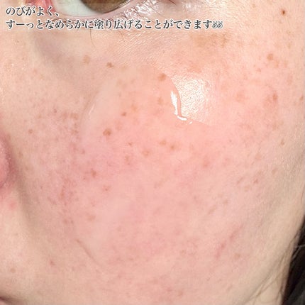 DRワンス Vニードル ショットセラム /Dr.Once/美容液を使ったクチコミ(4枚目)