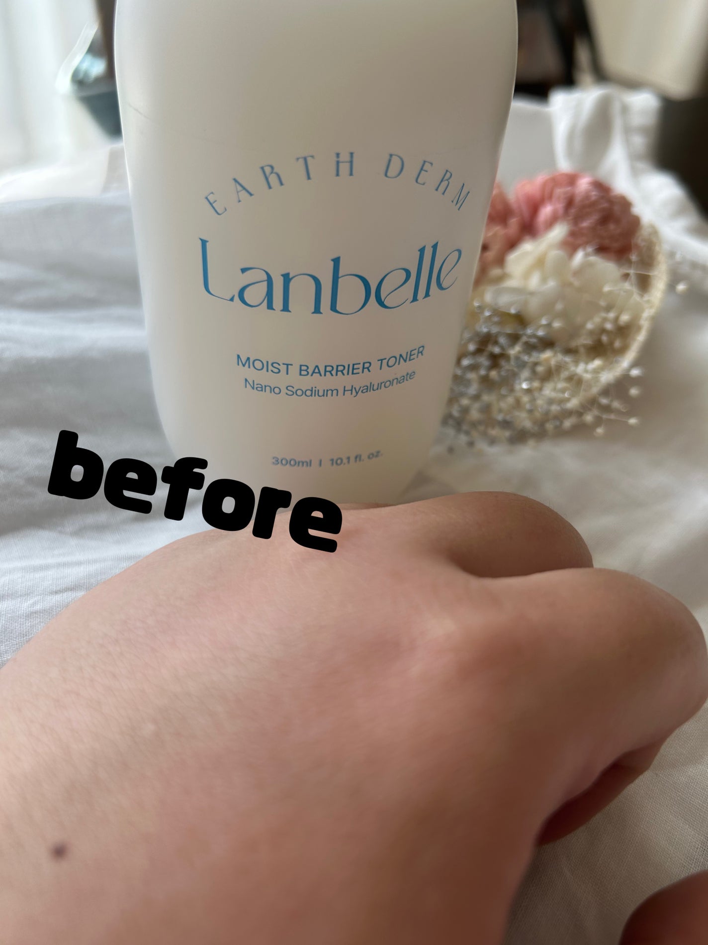 ぴーたろう🐹 on LIPS 「乾燥肌荒れさん必見☝️✨️ /本日は@lanbelle_jpさ..」(2枚目)