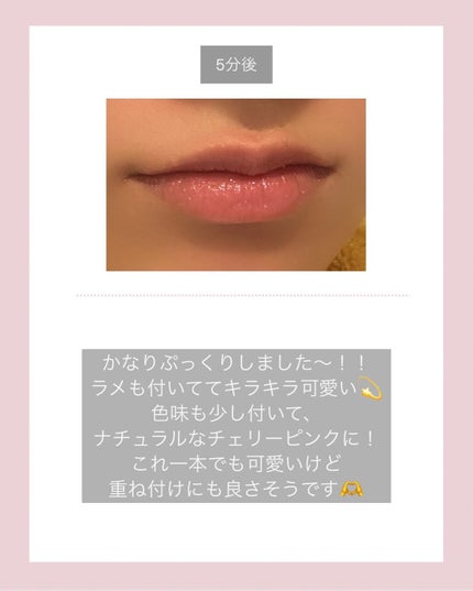 YNM キャンディーハニーリップバーム/YNM/リップバームを使ったクチコミ(5枚目)