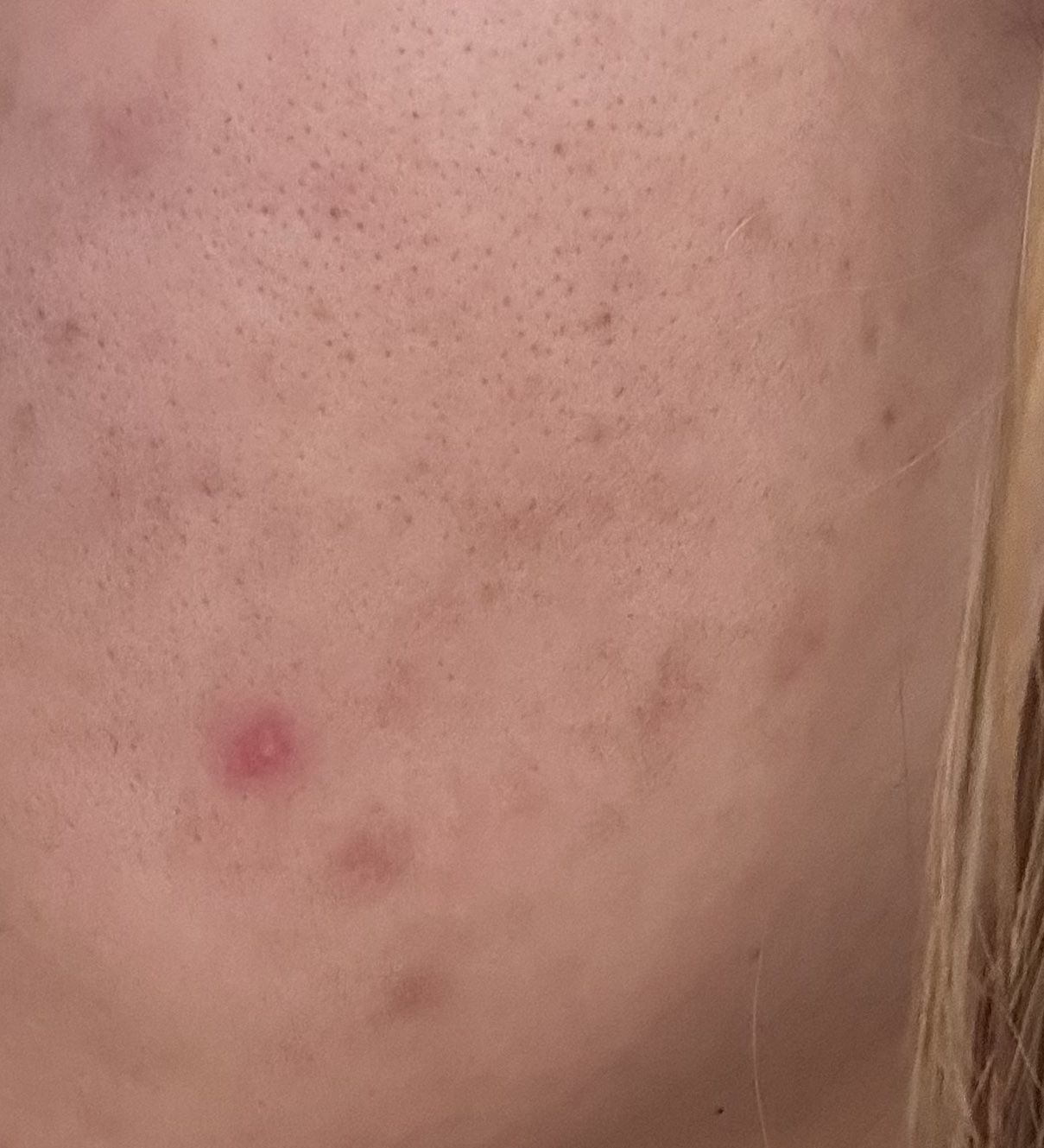 1番 ガルバニックパントテン酸スージングセラム/numbuzin/美容液を使ったクチコミ（3枚目）