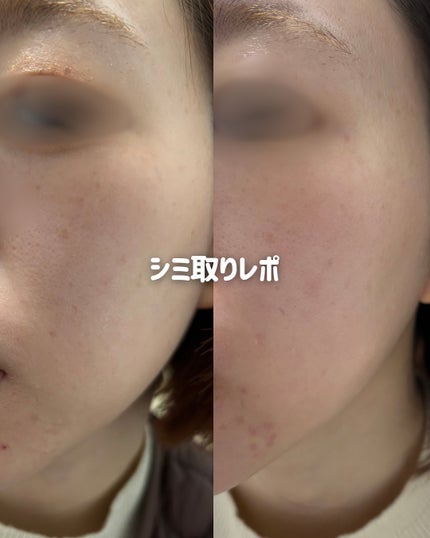 を使ったクチコミ(1枚目)