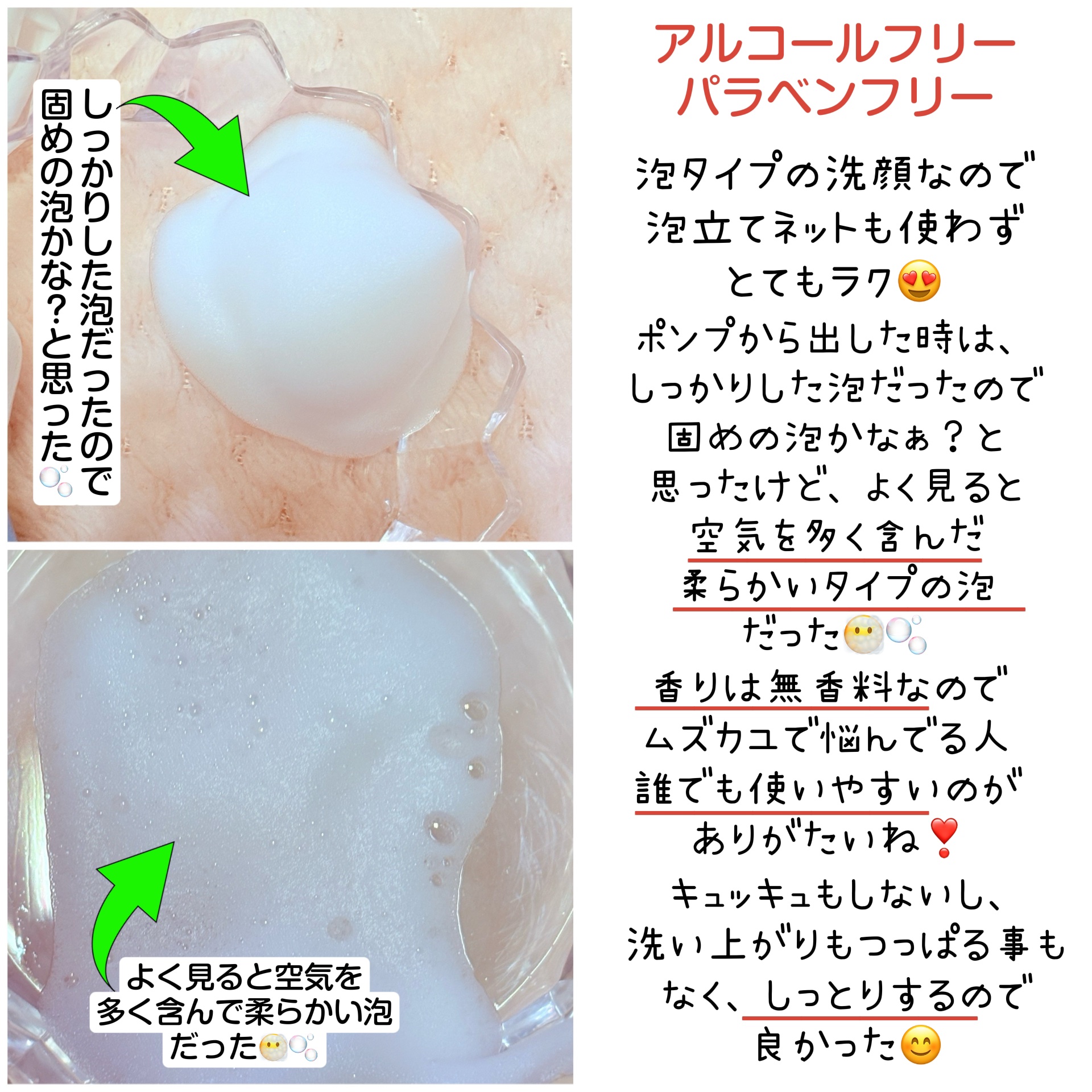 アレルジーナ 泡洗顔/マックス/泡洗顔を使ったクチコミ（3枚目）