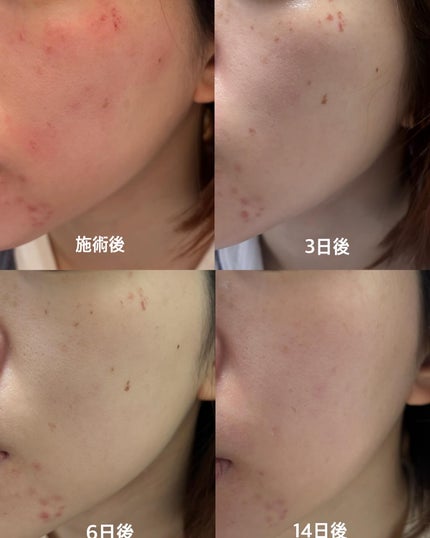 を使ったクチコミ(2枚目)