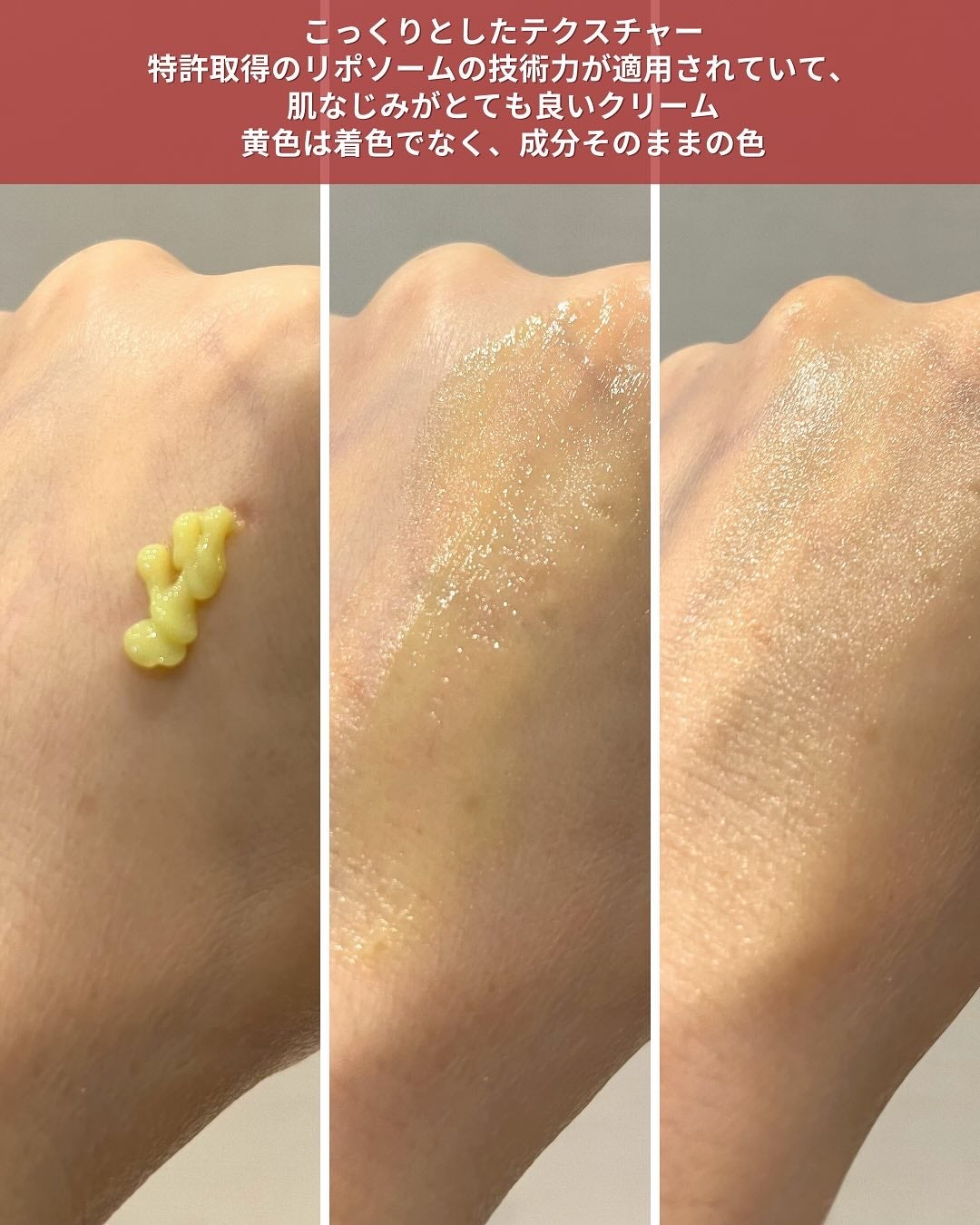 VITALIFT A forte/Dr.Different/フェイスクリームを使ったクチコミ(4枚目)