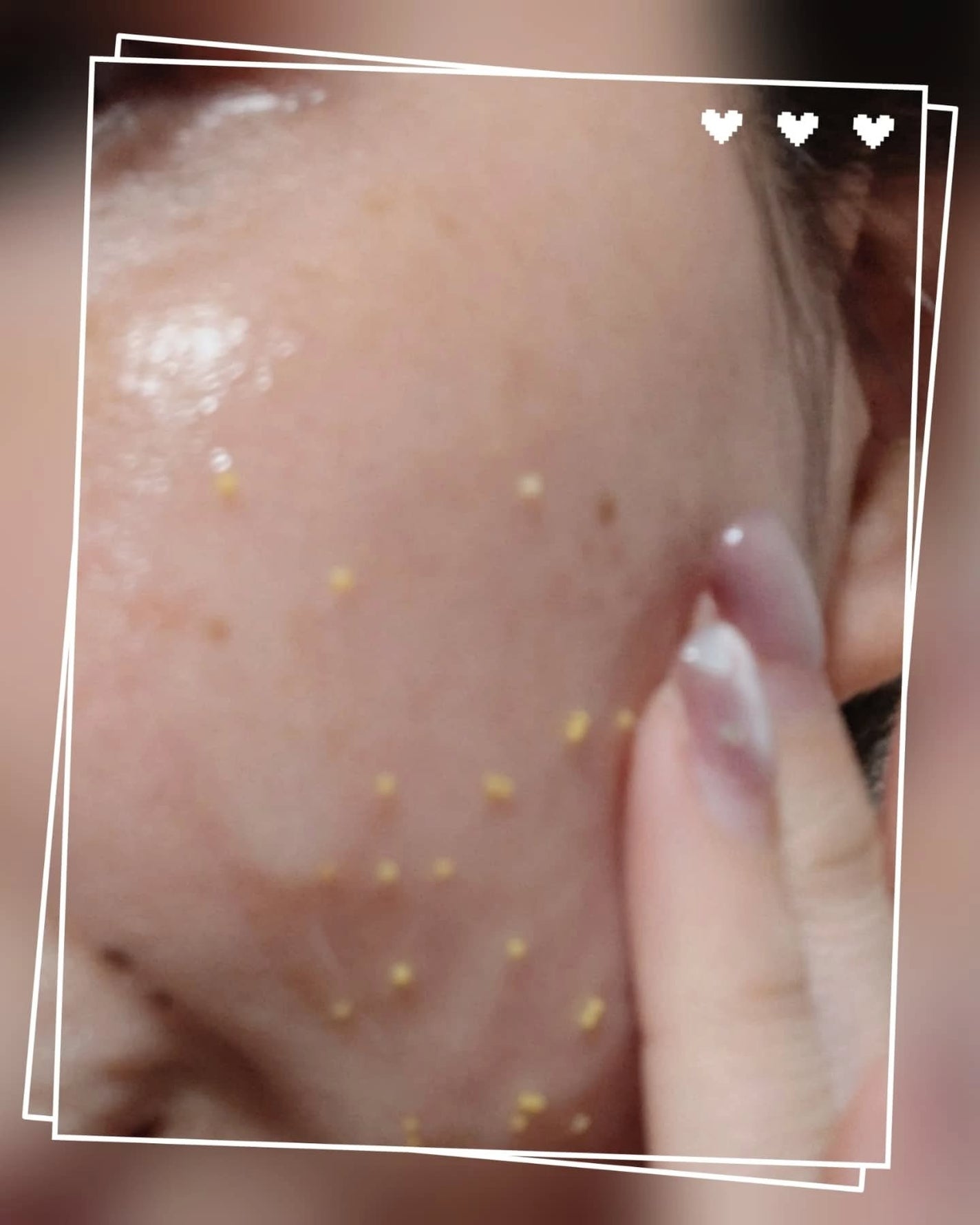 グルタチオンビタグローカプセル美容液/Genabelle/美容液を使ったクチコミ(5枚目)