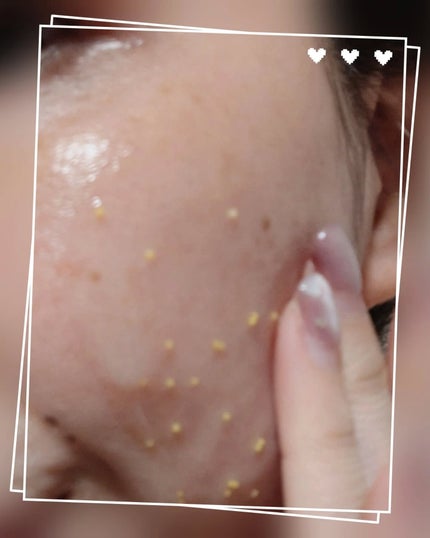 グルタチオンビタグローカプセル美容液/Genabelle/美容液を使ったクチコミ(5枚目)