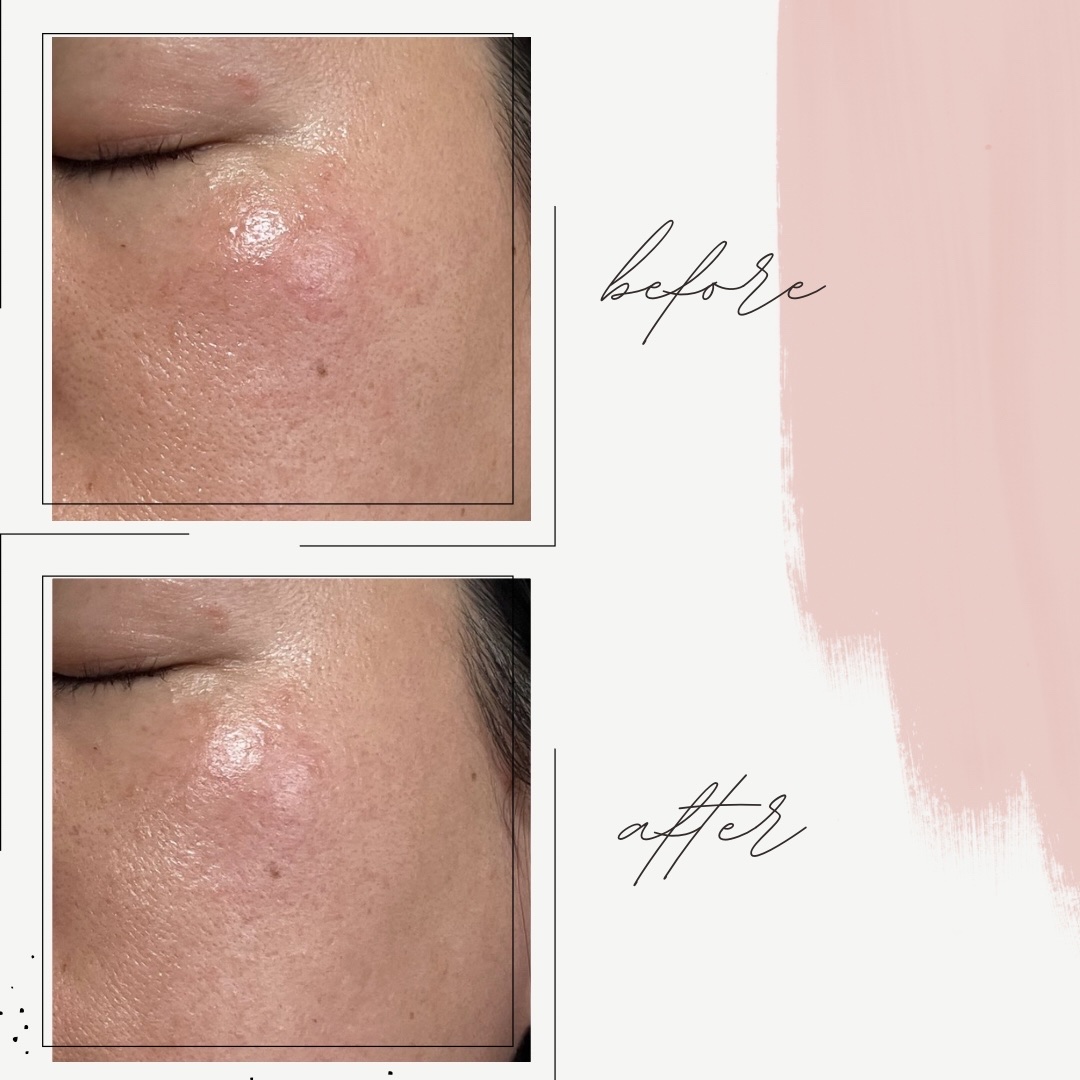 オルビス リンクルブライトＵＶプロテクター/オルビス/日焼け止めクリームを使ったクチコミ（3枚目）