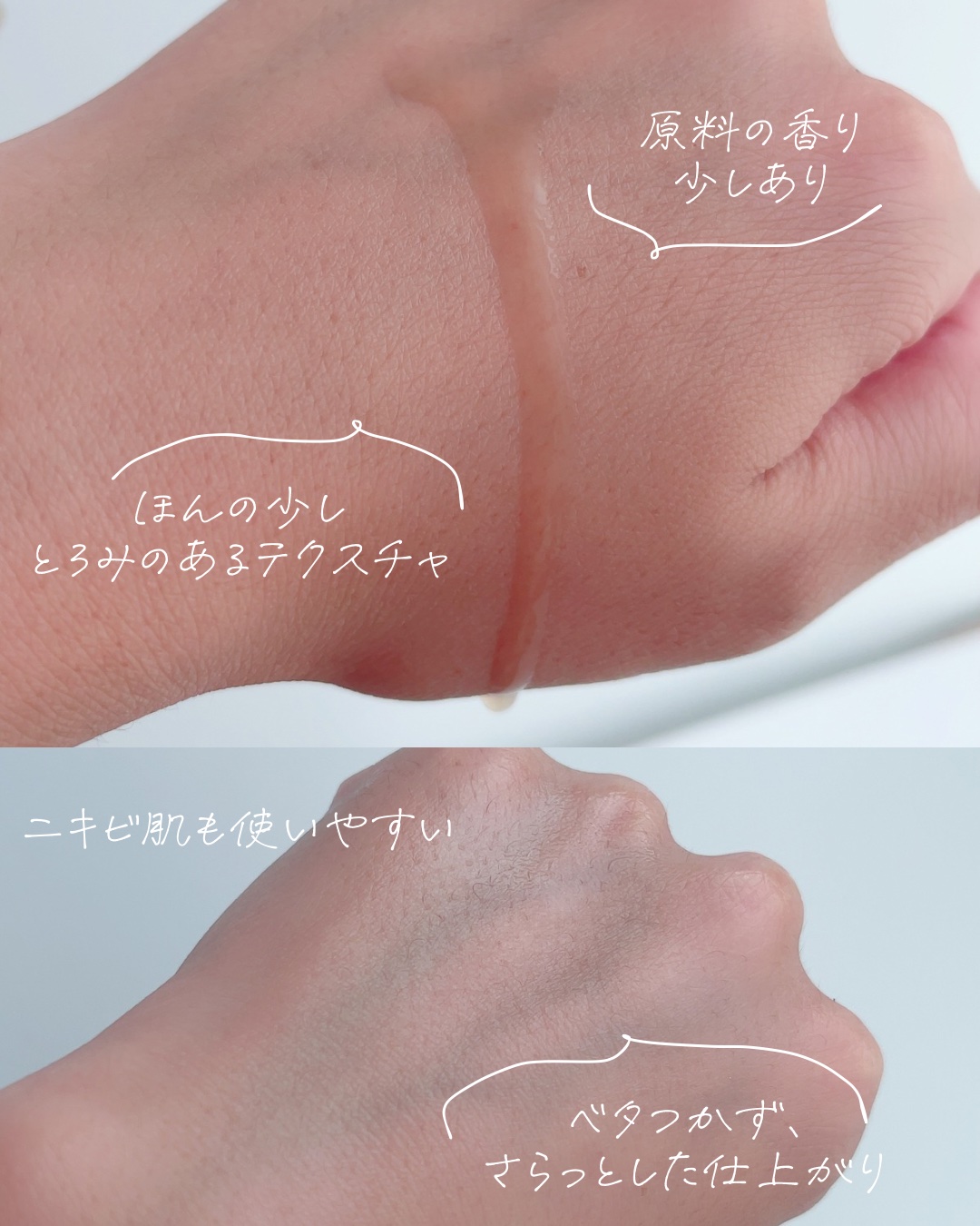 RXザ・アルファアルブチン2 ニキビ跡ケアセラム/COSRX/美容液を使ったクチコミ（3枚目）