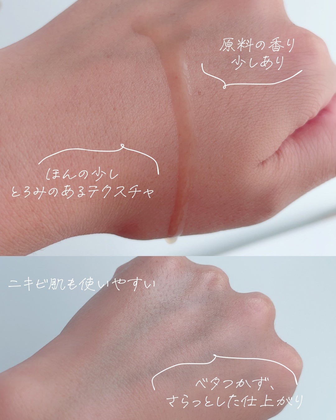 RXザ・アルファアルブチン2 ニキビ跡ケアセラム/COSRX/美容液を使ったクチコミ(3枚目)