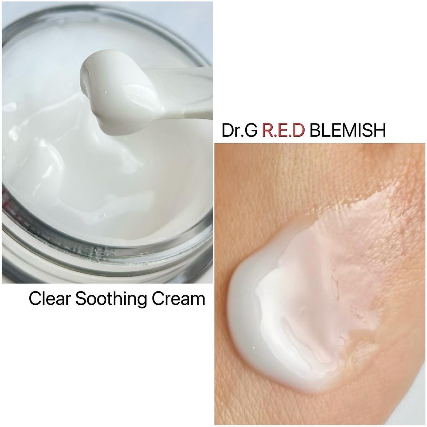 レッドブレミッシュ クリアスージングクリーム/Dr.G/フェイスクリームを使ったクチコミ(6枚目)