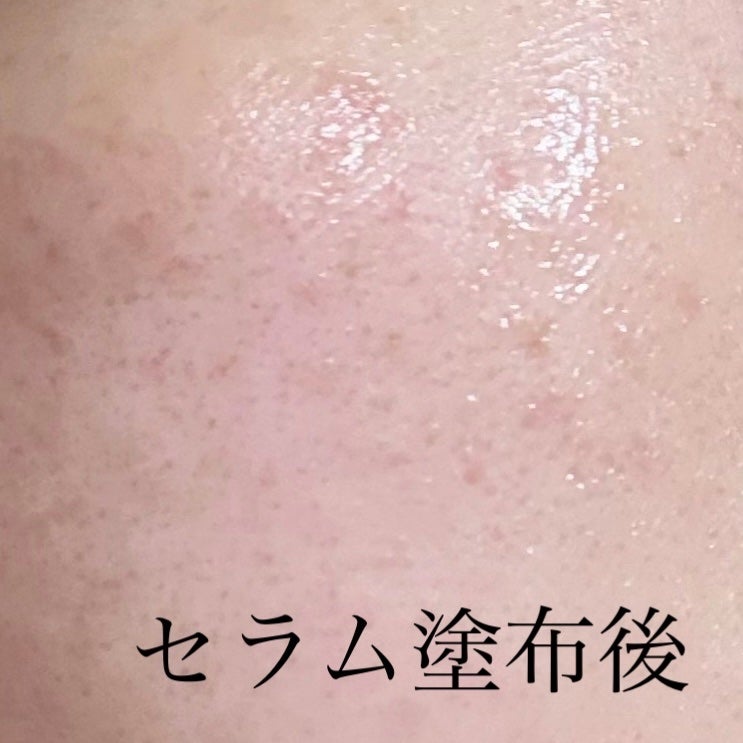 サミュ PHセンシティブクリーム/SAM'U/フェイスクリームを使ったクチコミ(4枚目)