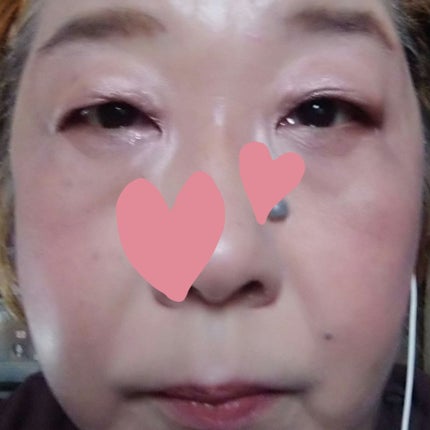 ダブル セラム バーム ファンデーション/Dr.Althea/クリーム・エマルジョンファンデーションを使ったクチコミ(3枚目)