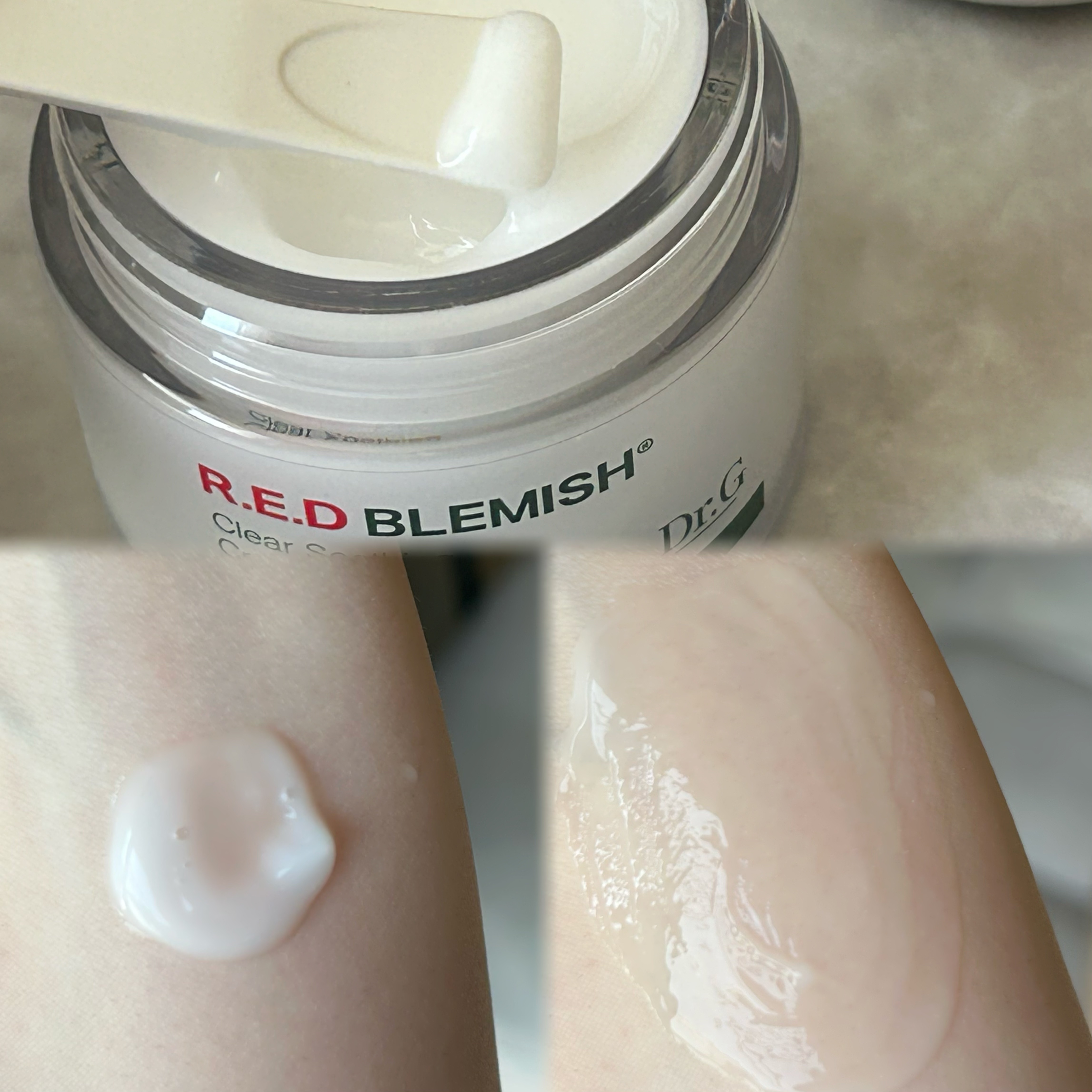 レッドブレミッシュ クリアスージングクリーム/Dr.G/フェイスクリームを使ったクチコミ（3枚目）