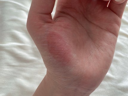 リップポーション シュガーグレーズティント/alternativestereo/リップティントを使ったクチコミ(4枚目)