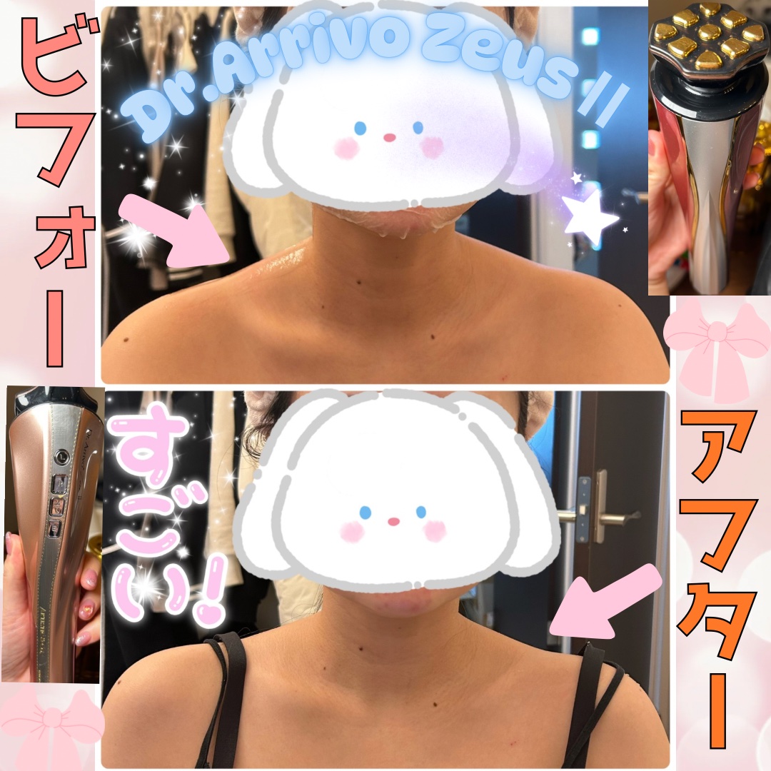 Dr.Arrivo ZeusII/ARTISTIC＆CO./美顔器・マッサージを使ったクチコミ（1枚目）