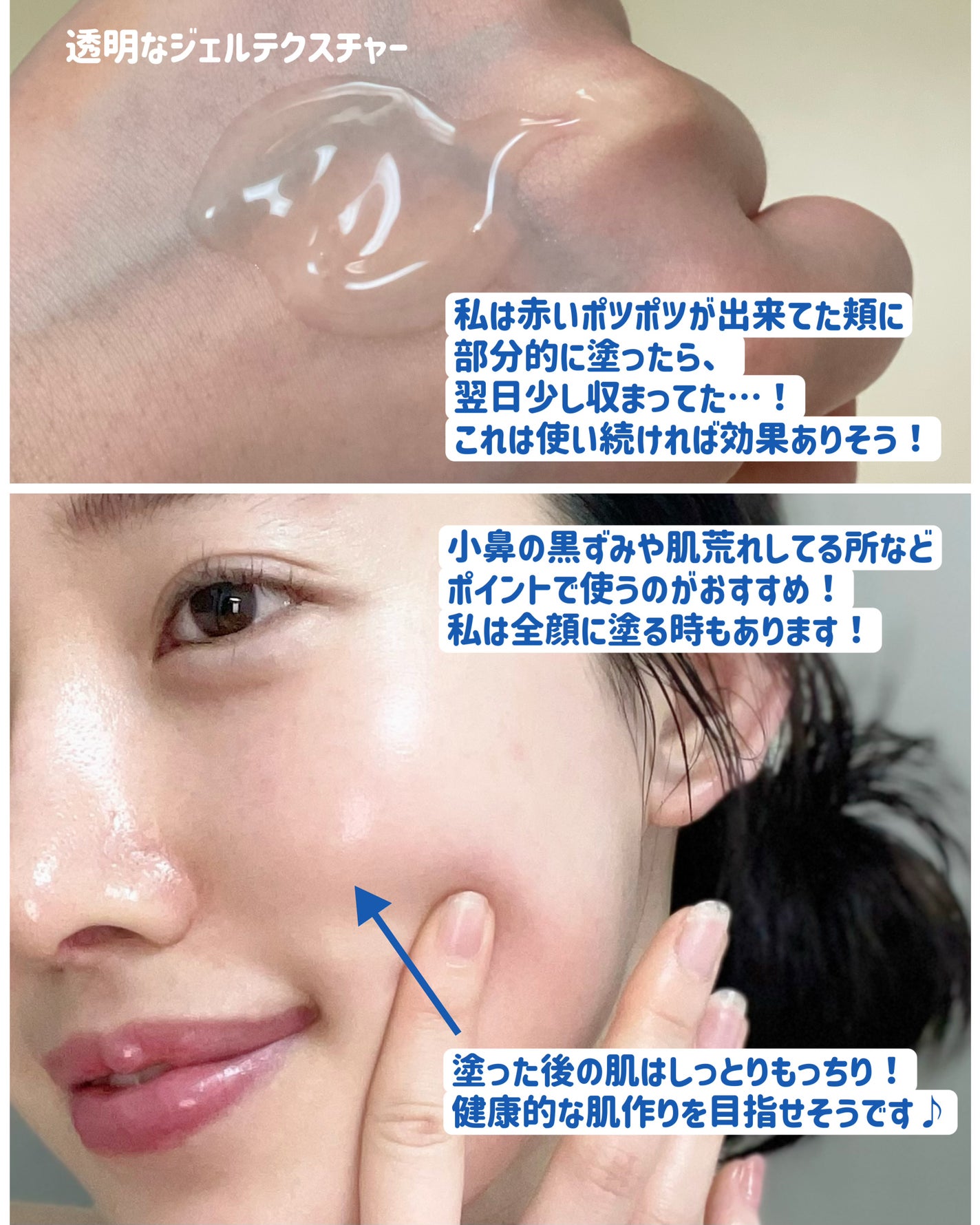 ACクリーム/LEPOREM/フェイスクリームを使ったクチコミ(4枚目)