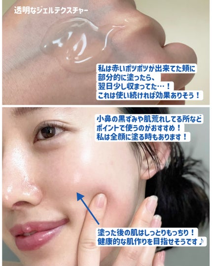 ACクリーム/LEPOREM/フェイスクリームを使ったクチコミ(4枚目)