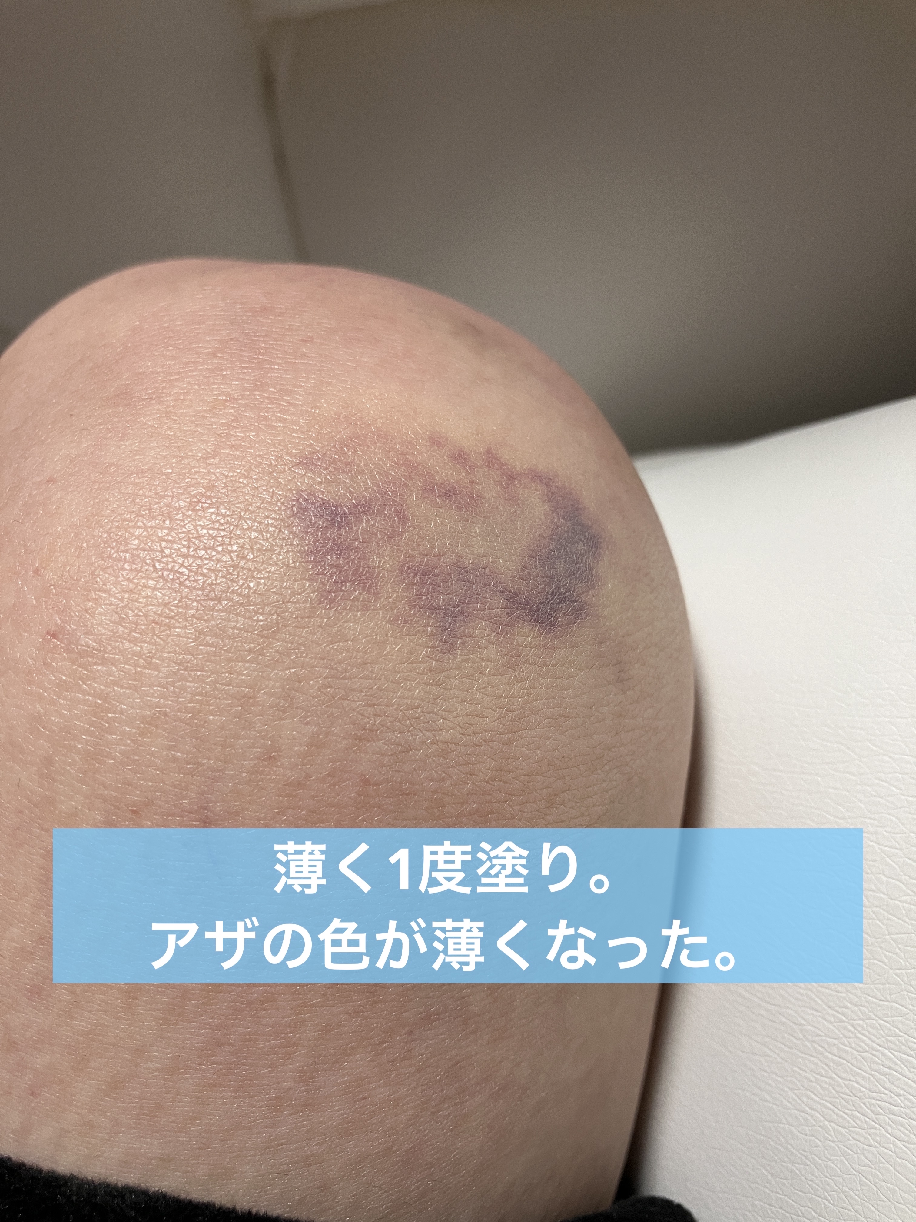 キルカバー メッシュ グロウ エッセンシャル クッション/CLIO/クッションファンデーションを使ったクチコミ（3枚目）