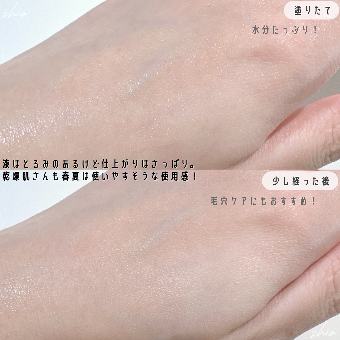 レッドブレミッシュ クリアヒアルシカスージングセラム/Dr.G/美容液を使ったクチコミ（3枚目）