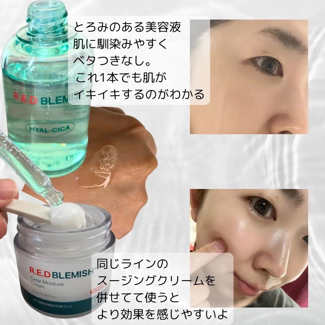 レッドブレミッシュ クリアスージングクリーム/Dr.G/フェイスクリームを使ったクチコミ(2枚目)