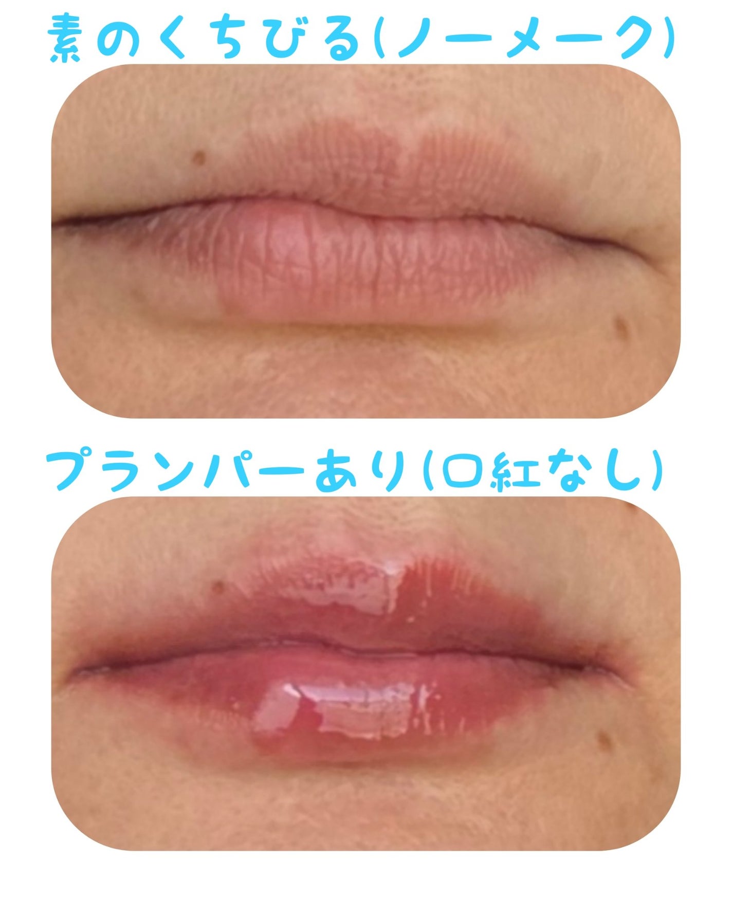 ボリュームリッププランパー/BANILA CO/リッププランパーを使ったクチコミ(2枚目)