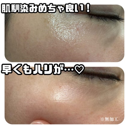 ☆scallop☆フォロバ100%☆ on LIPS 「話題の超高濃縮アンプル登場!《celladixセラディックス》..」(5枚目)