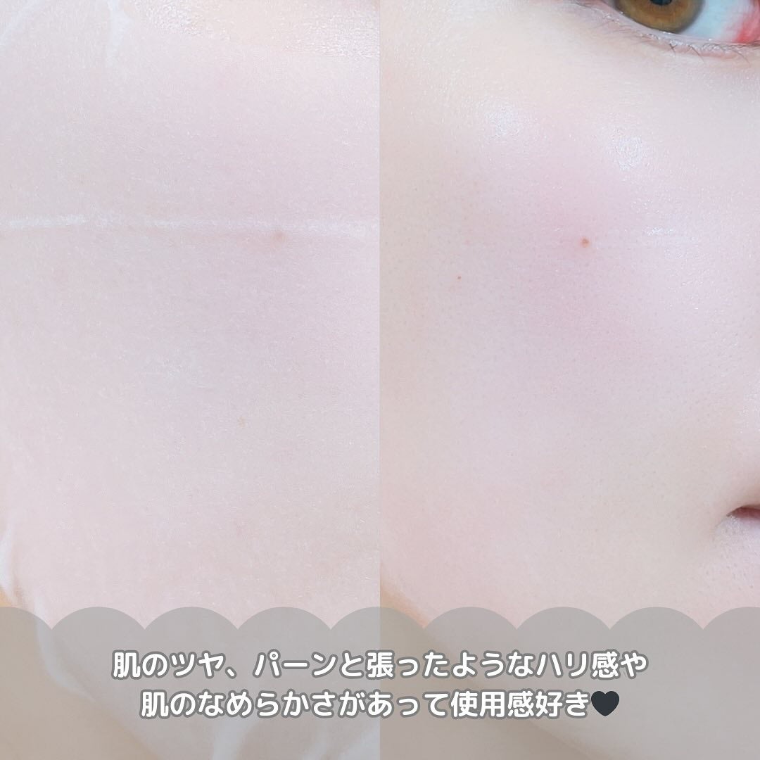 ブラックPDRN デイリーシートマスク/ネイチャーリパブリック/シートマスク・パックを使ったクチコミ(4枚目)