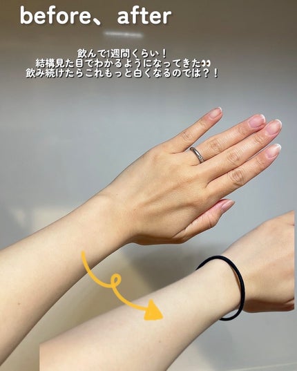 白白丸/ミオル韓医院/美容サプリメントを使ったクチコミ(4枚目)