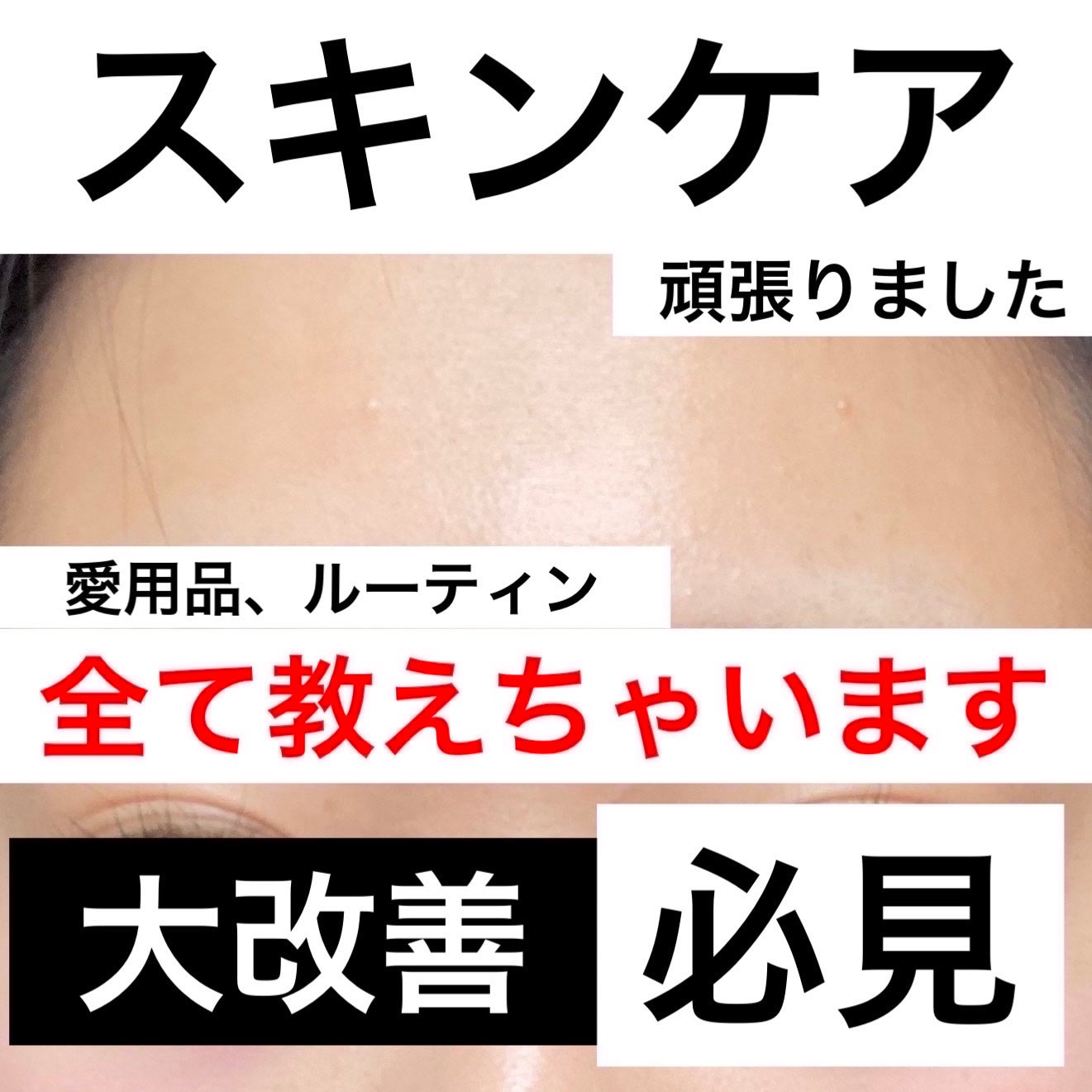 ティーツリーシカスージングトナー/BRING GREEN/化粧水を使ったクチコミ(1枚目)