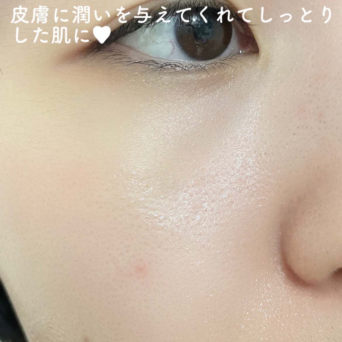 フリアージュGLセラム/フリアージュ/美容液を使ったクチコミ(6枚目)