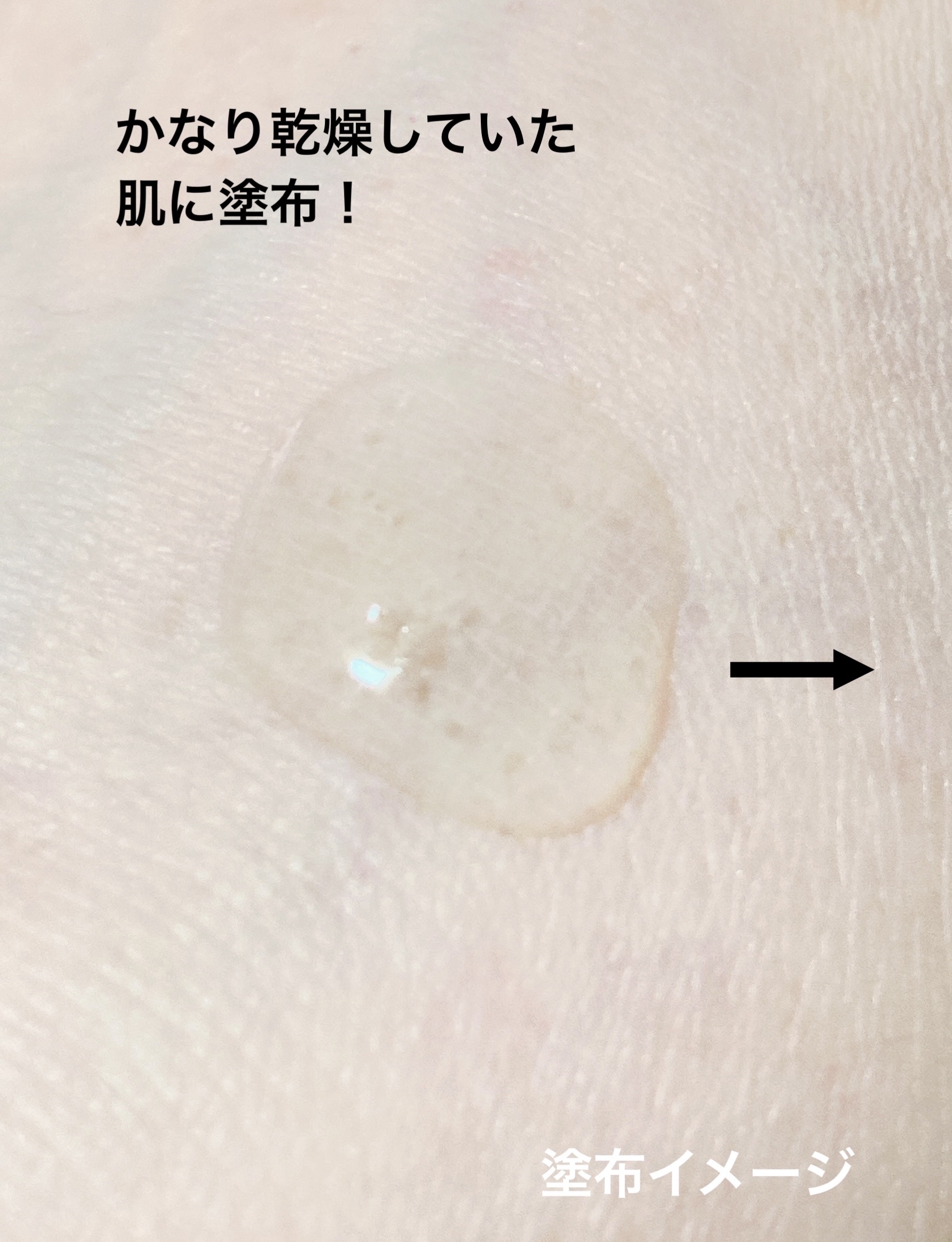 TXA10%ブライトニングセラム 30ml/Real Barrier/美容液を使ったクチコミ（3枚目）