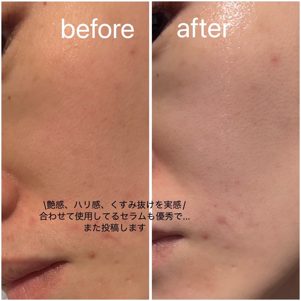 YOUTH&GLOW DROP/SERUMKIND/美容液を使ったクチコミ(5枚目)