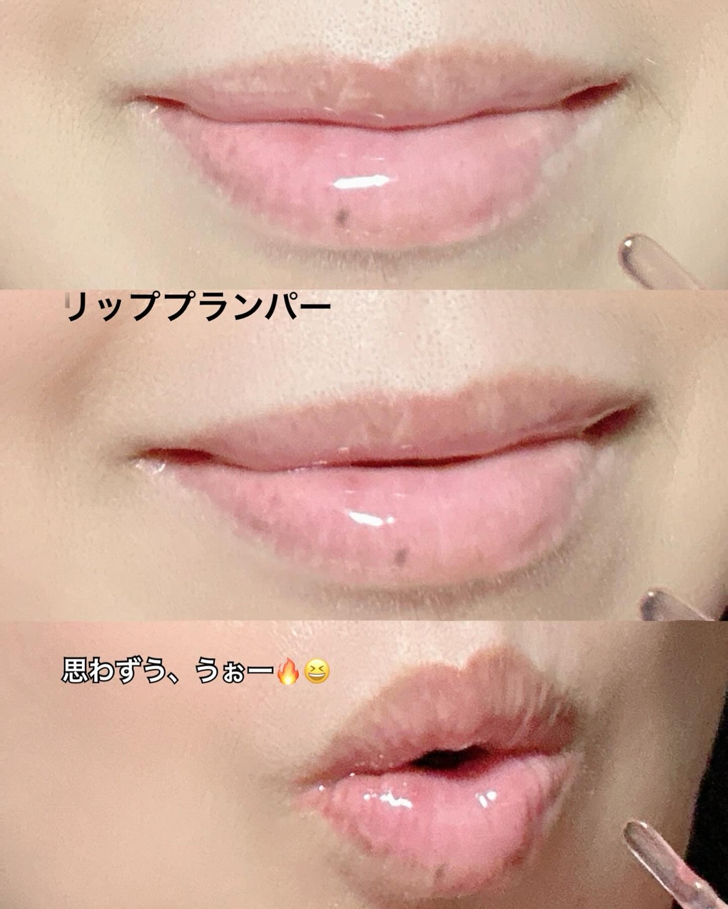 PDRNショット リッププランパー/fractionalCC/リッププランパーを使ったクチコミ(8枚目)