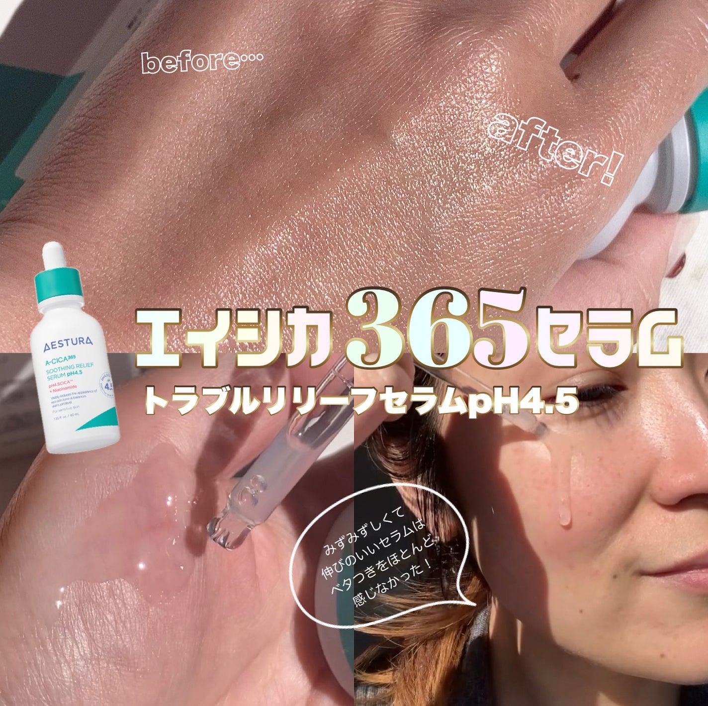 エイシカ365クイックマスクパッド/AESTURA/トナーパッドを使ったクチコミ(3枚目)