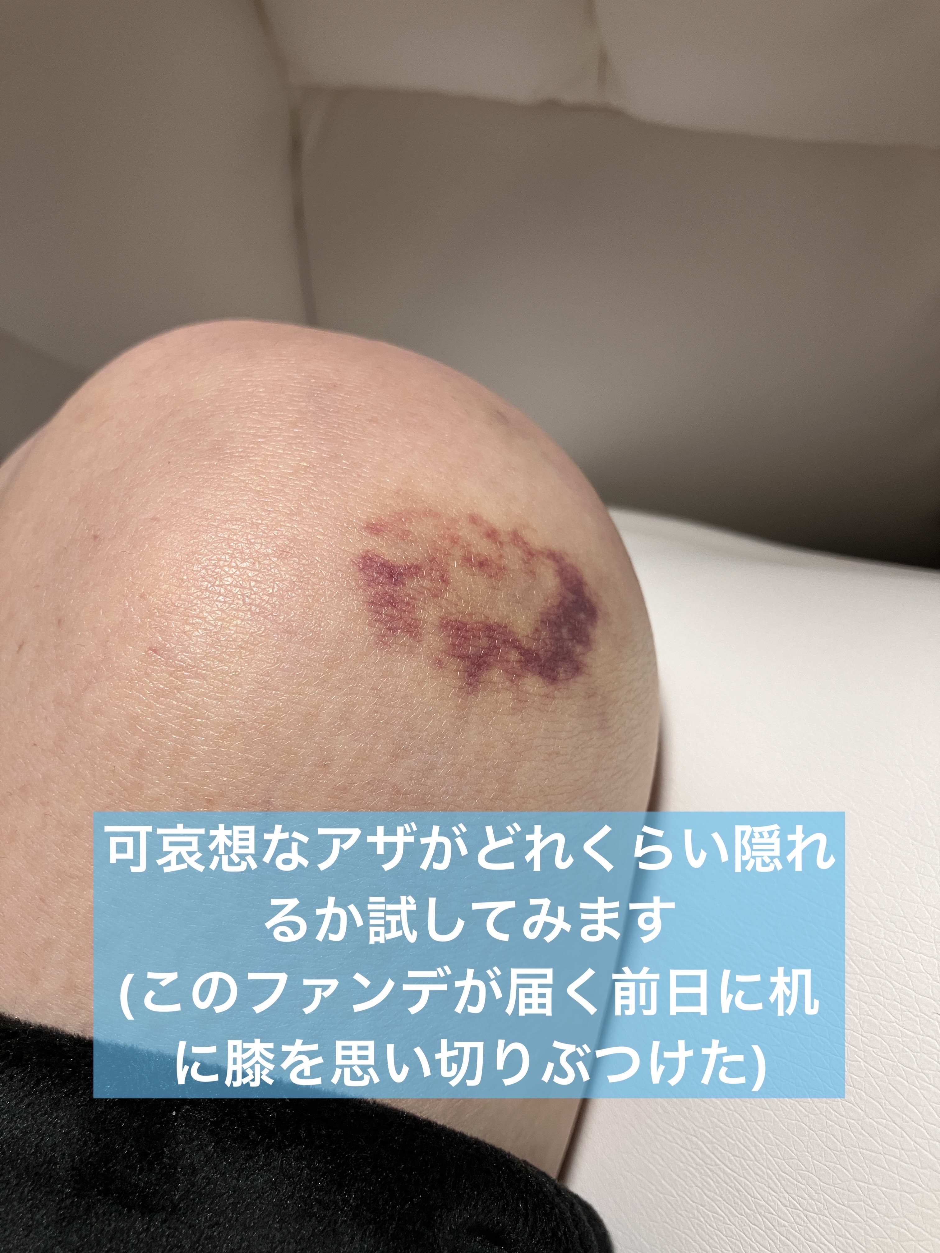 キルカバー メッシュ グロウ エッセンシャル クッション/CLIO/クッションファンデーションを使ったクチコミ（2枚目）