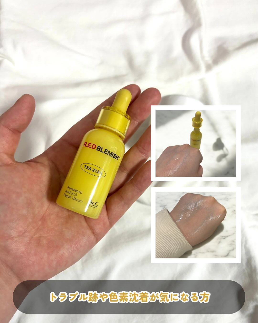 レッドブレミッシュ リペアスージングクリーム/Dr.G/フェイスクリームを使ったクチコミ（2枚目）